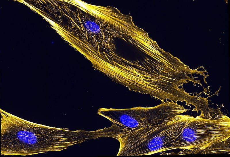 Visual representation of myoblast actin bundles